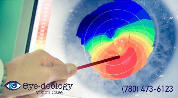 Optical Coherence Tomography (OCT) Eye Exams in Edmonton