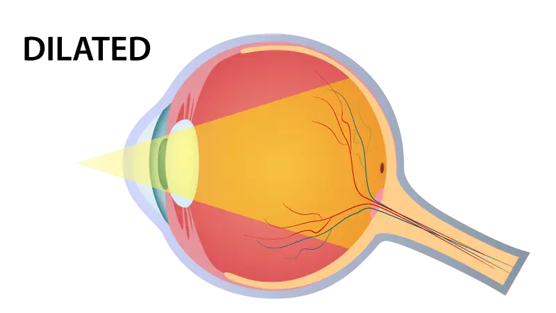 Dilated Eye Exam