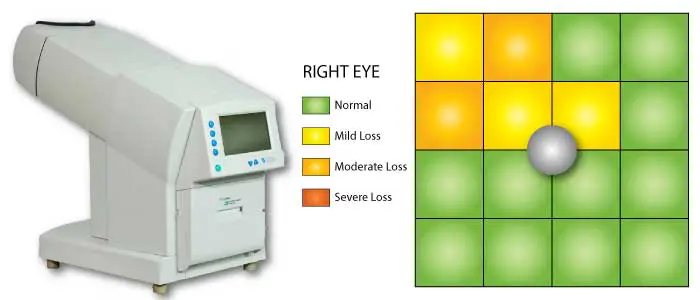 Our Edmonton Eye Exams - Visual Field Screening: assessing peripheral vision
