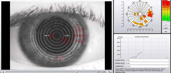 Our Edmonton Eye Exams -  Dry Eye Testing: tear film analysi