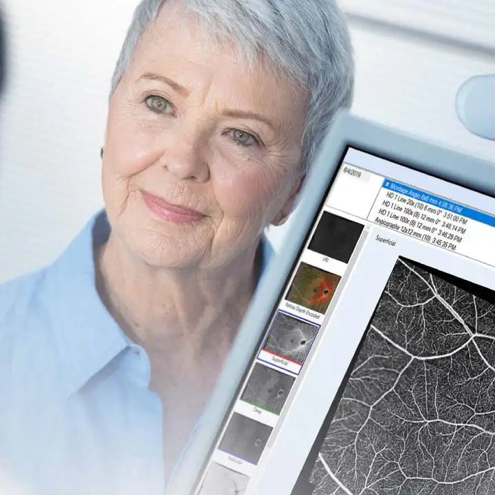 OCT Eye Exam in Edmonton OCT Eye Exam in Edmonton