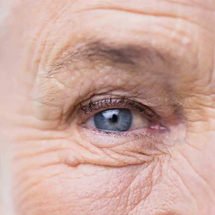 Senior Comprehensive Eye Exams