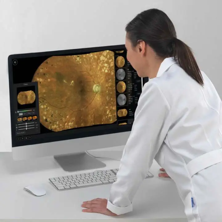 Wide Angle Retinal Photography Eye Exam in North Edmonton