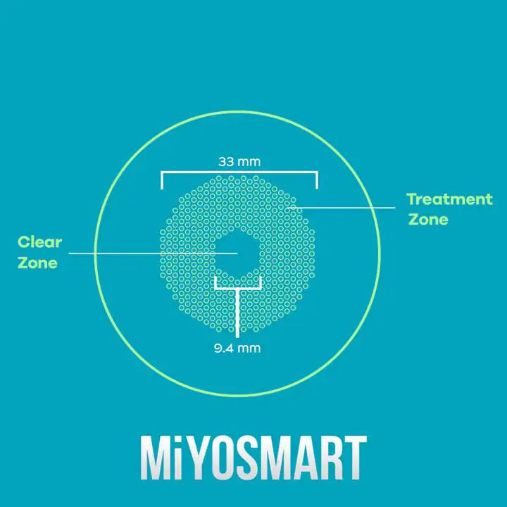Hoya MiYOSMART Myopia Control Eyeglass Lens Treatment Zones