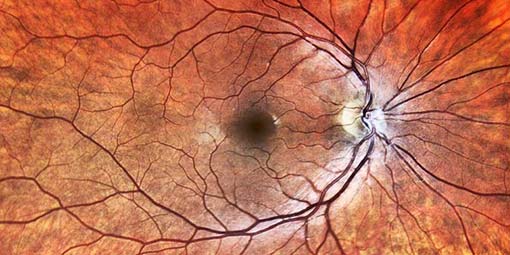 The Retina Is The Back Portion Of The Eye Responsible For Vision