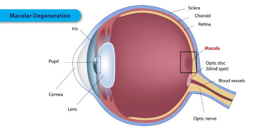 Age-Related Macular Degeneration (AMD)  - Symptoms, Causes and Treatment