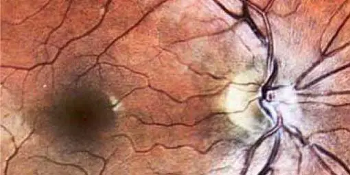 Importance of Advanced Eye Exam Technologies