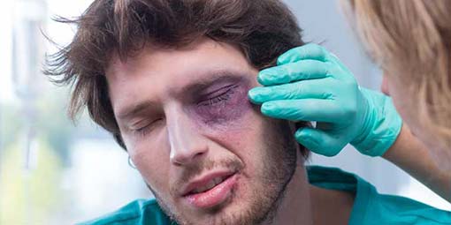 Eye Injury Caused Through Playing Sports